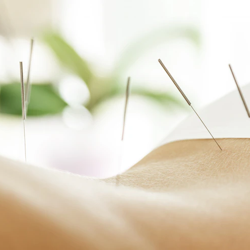 cropped-acupuncture.png